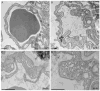 Fig. 13