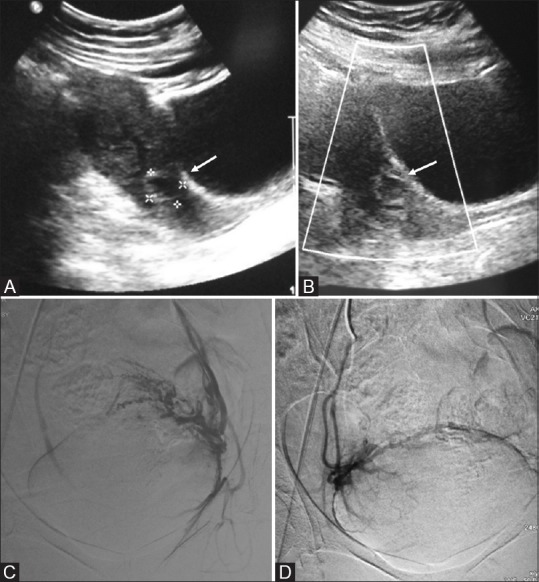 Figure 6(A-D)