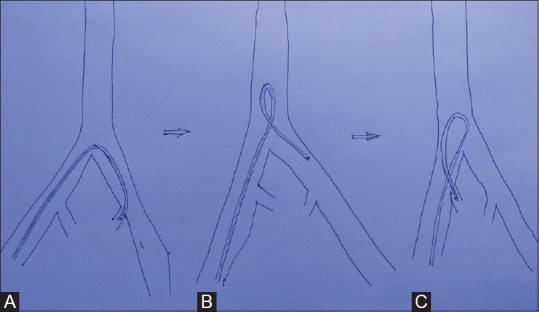 Figure 1(A-C)