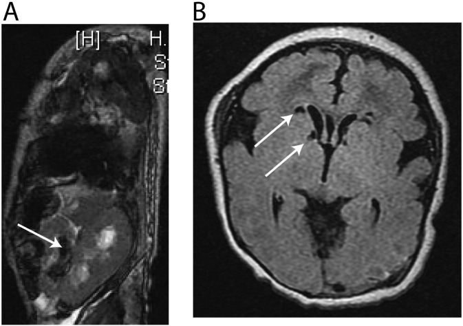 Fig. 1