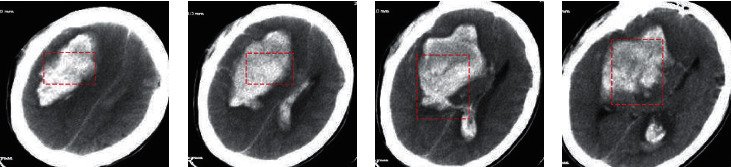 Figure 10