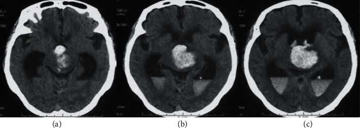 Figure 11