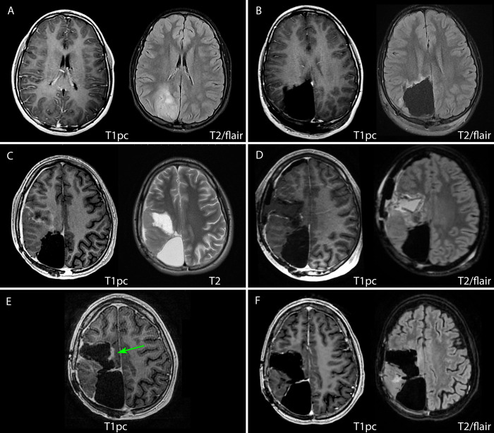 FIG. 1