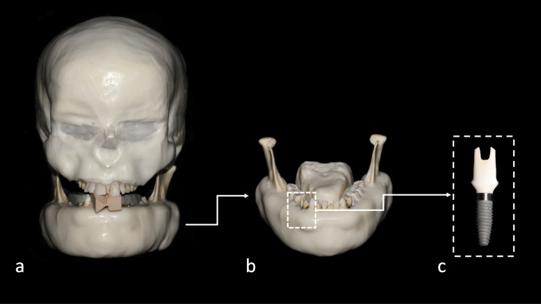 Fig. 1