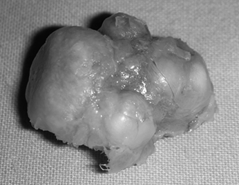 Fig. 3