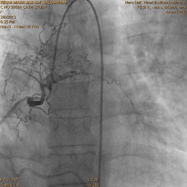 Fig. 2