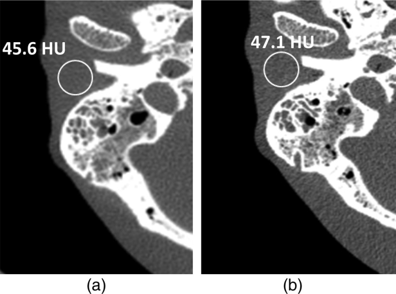 Fig. 11