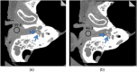 Fig. 10