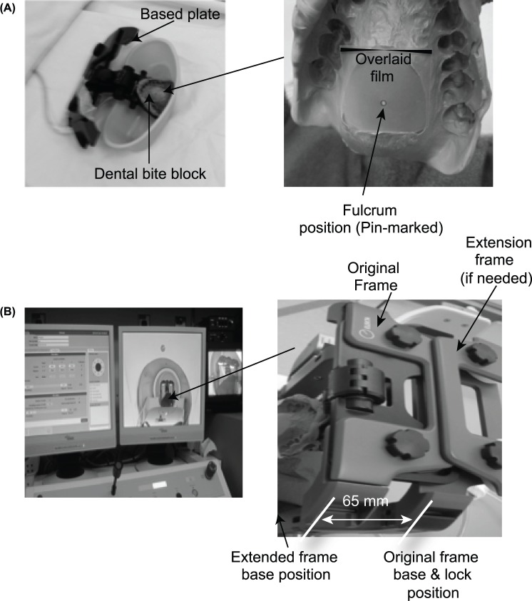 Figure 1: