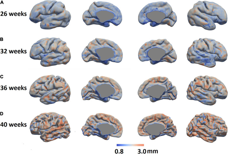 FIGURE 13