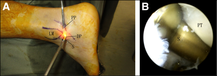 Fig 3