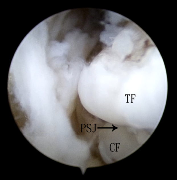 Fig 5