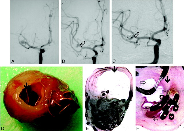 Fig 2.