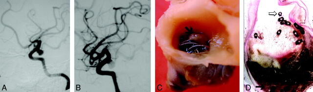 Fig 1.