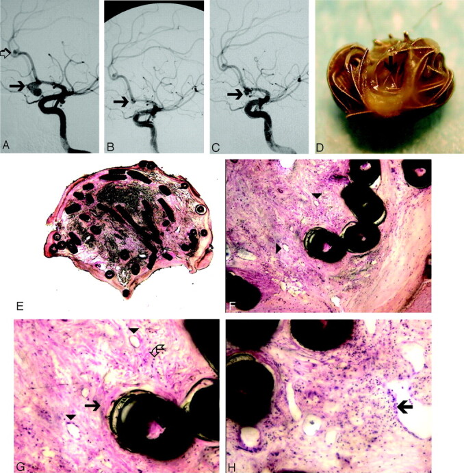 Fig 3.