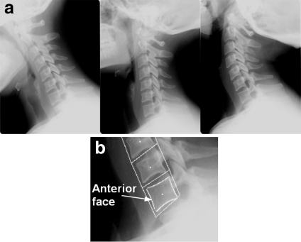 Fig 1