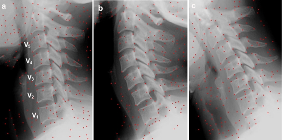 Fig 2