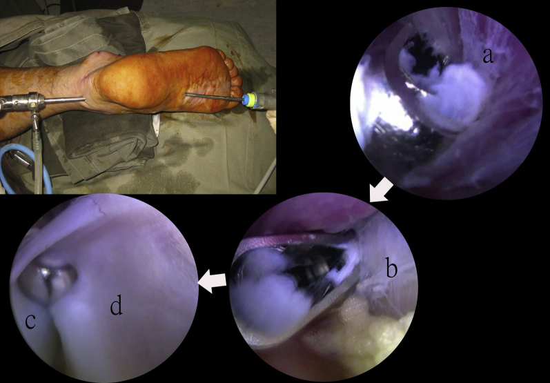 Fig 2