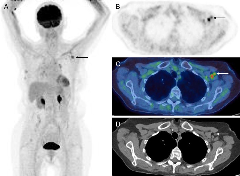 FIGURE 3