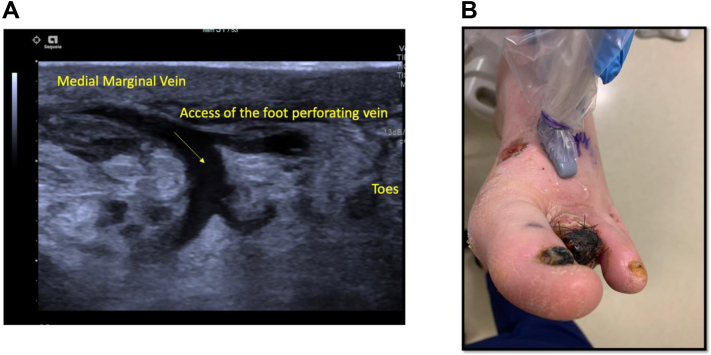 Fig 2