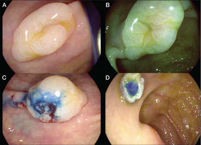 Figure 1)