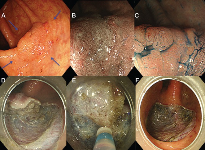 Figure 4)