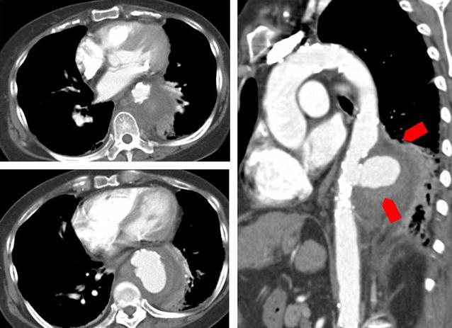 Fig. 2