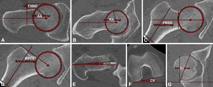 Fig. 1A–G