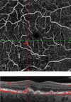 Fig. 4