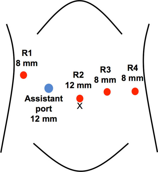 Fig. 2