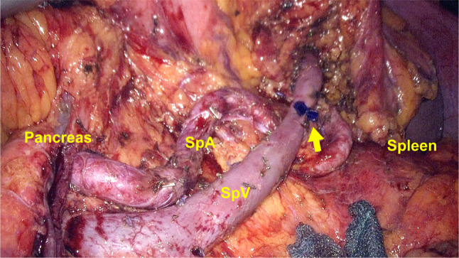 Fig. 4