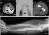 FIG. 1.
