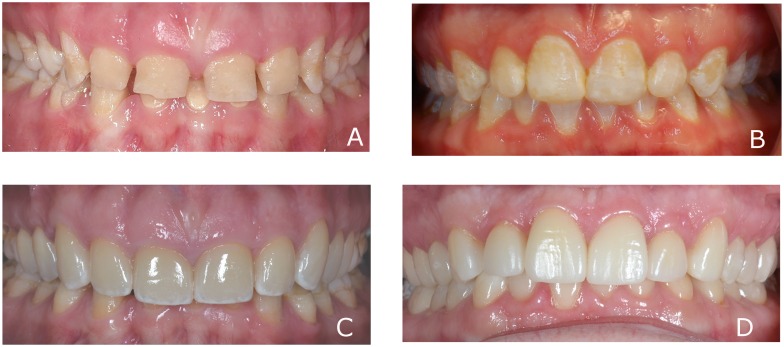 Fig 1