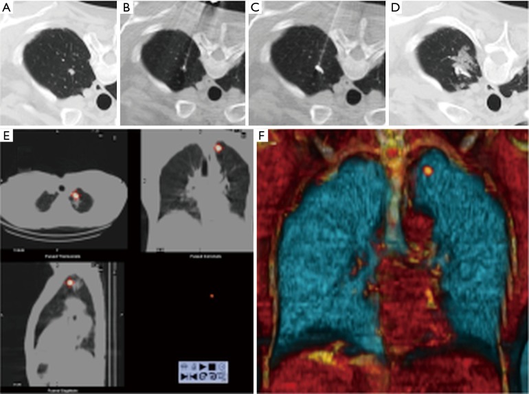 Figure 18