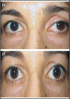 fig.1a