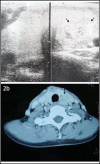 Fig.2a