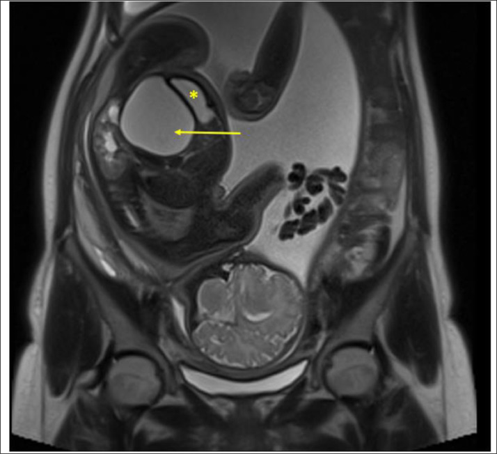 Fig 2: