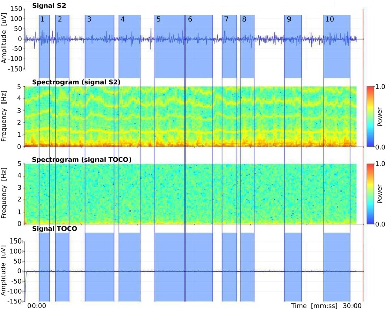 Fig 3