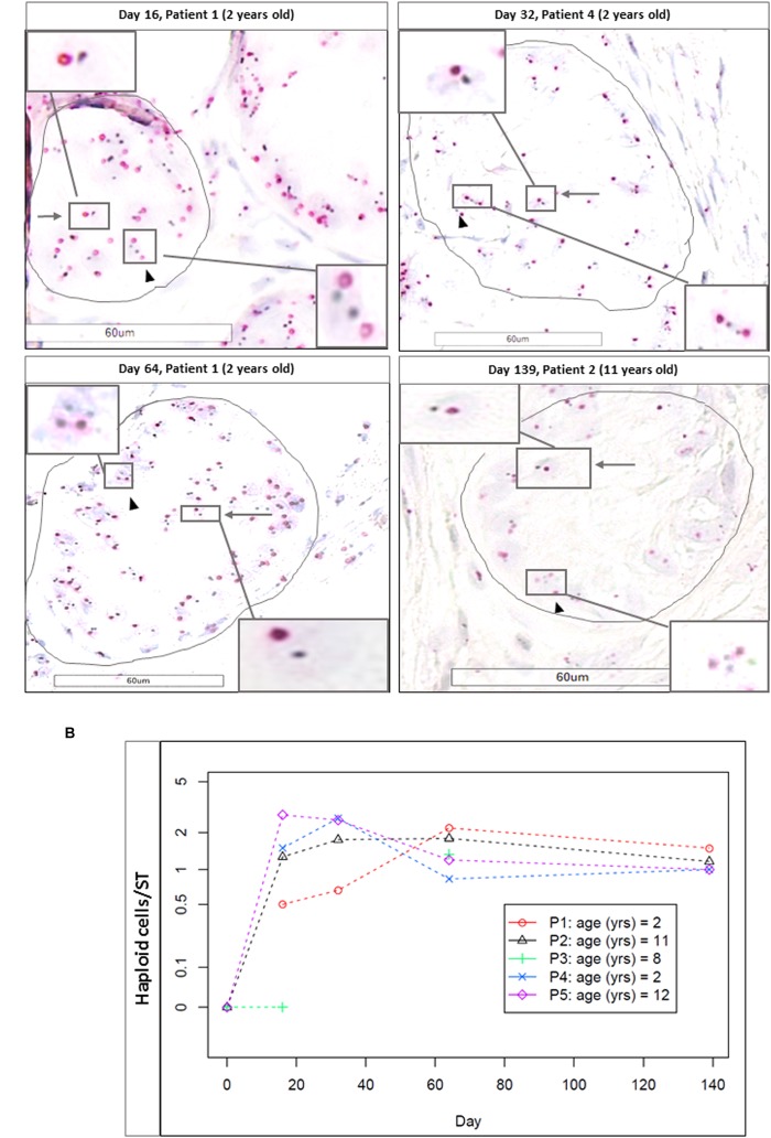 FIGURE 11