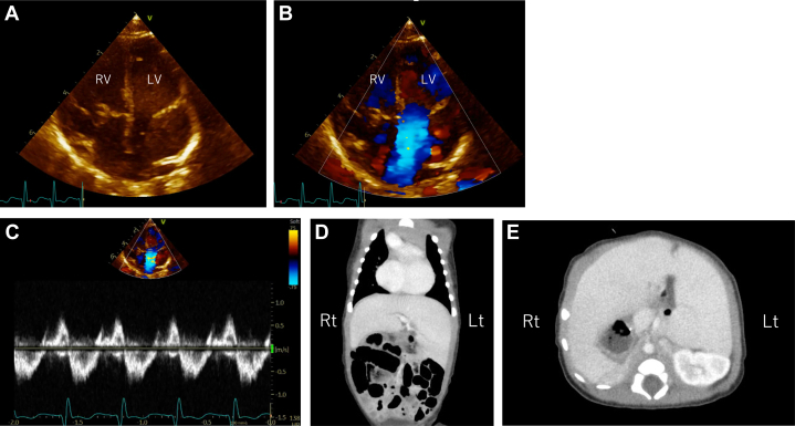 Figure 3