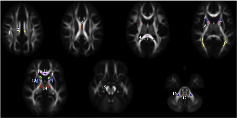 Fig. 1