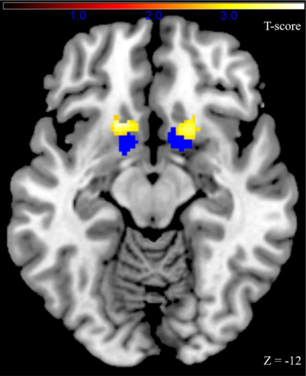 Figure 3