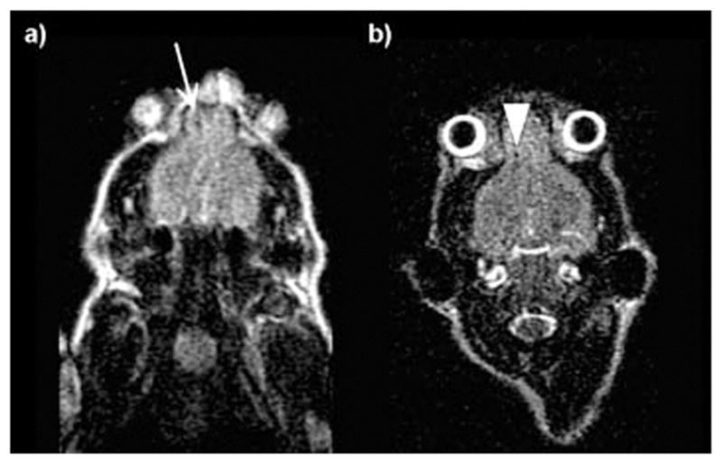 Fig. 14