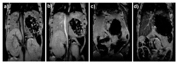 Fig. 13