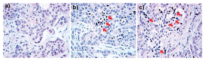 Fig. 17