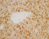 Fig. 11