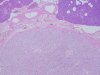 Fig. 12