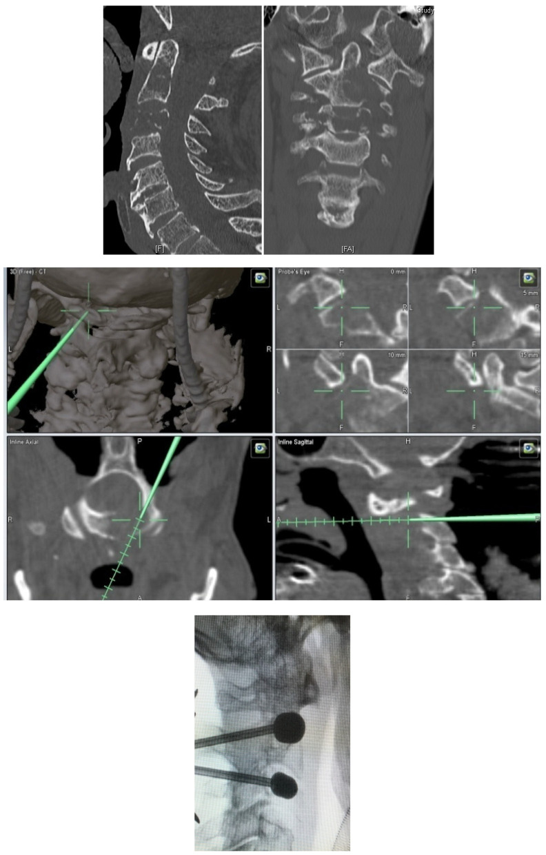 Figure 2