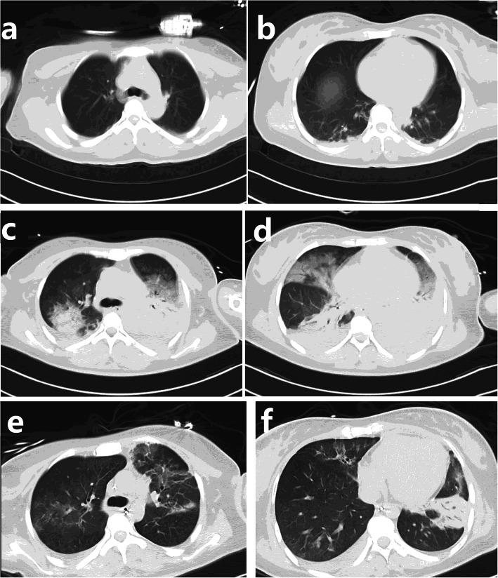 Fig. 1