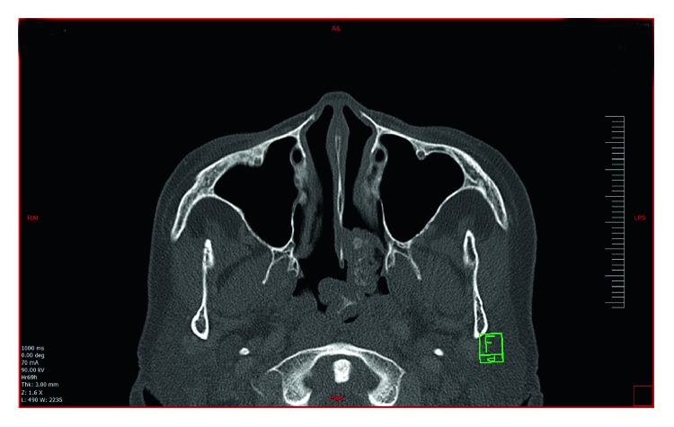 Figure 2